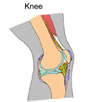 JuvenileRheumatoid Arthritis