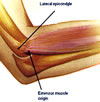 JuvenileRheumatoid Arthritis